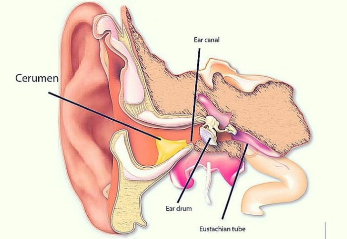 Cerumen en el oído