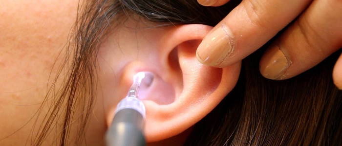 Tapones de Cera en oído