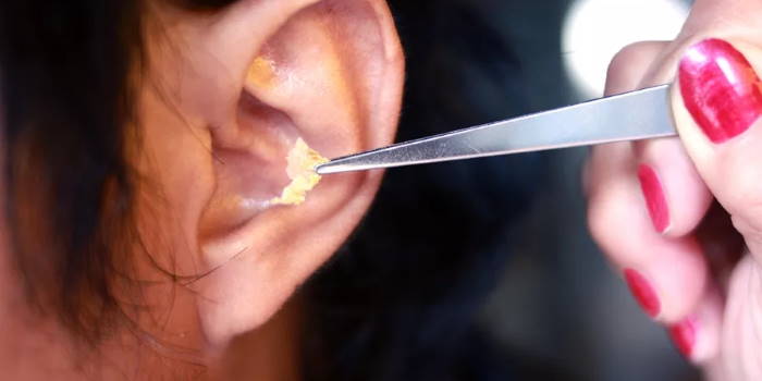 Tapones de Cera en oído